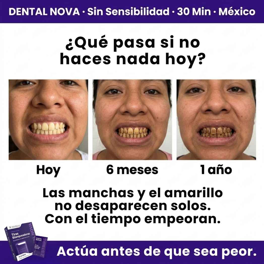 Tiras Blanqueadoras Estirables - Elimina Manchas y Tono Amarillo en 30 Minutos