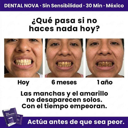 Tiras Blanqueadoras Estirables - Elimina Manchas y Tono Amarillo en 30 Minutos