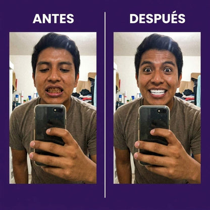 Tiras Blanqueadoras Estirables - Elimina Manchas y Tono Amarillo en 30 Minutos