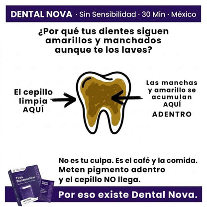 Tiras Blanqueadoras Estirables - Elimina Manchas y Tono Amarillo en 30 Minutos