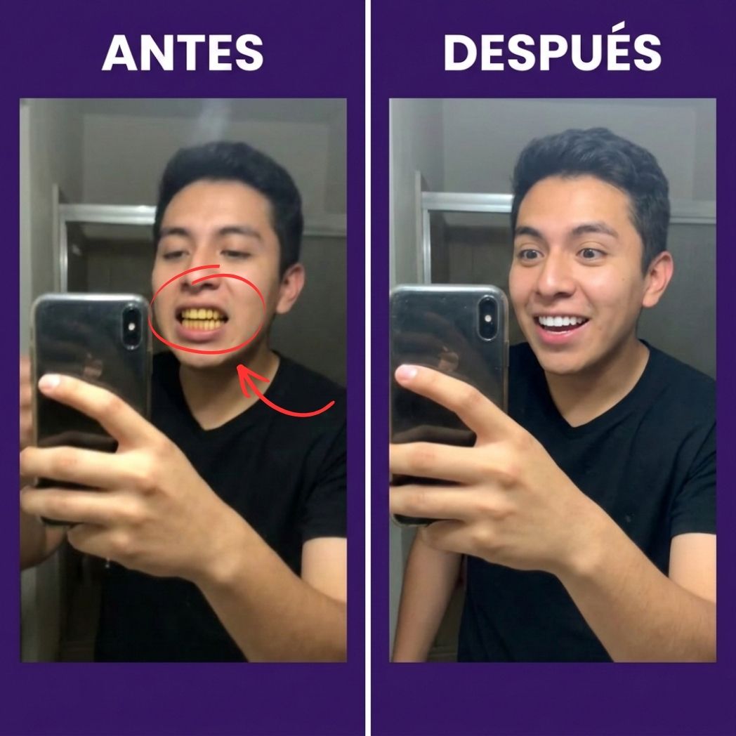 Tiras Blanqueadoras Estirables - Elimina Manchas y Tono Amarillo en 30 Minutos