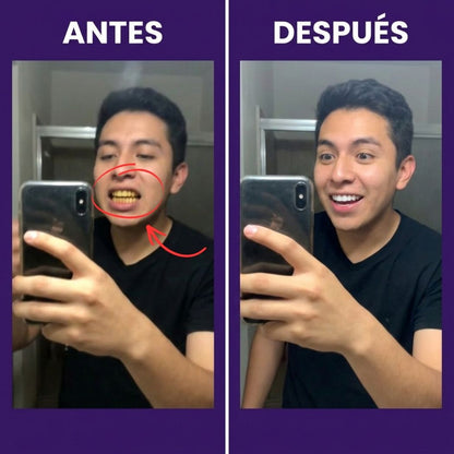 Tiras Blanqueadoras Estirables - Elimina Manchas y Tono Amarillo en 30 Minutos