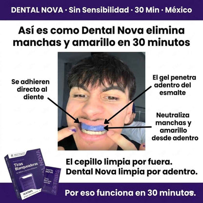 Tiras Blanqueadoras Estirables - Elimina Manchas y Tono Amarillo en 30 Minutos