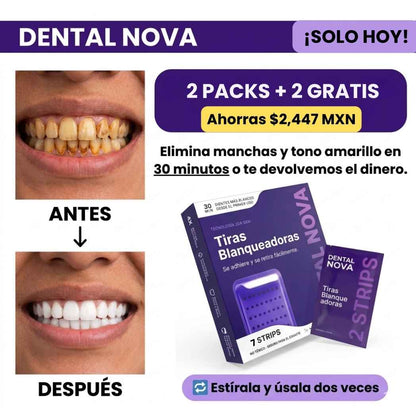 Tiras Blanqueadoras Estirables - Elimina Manchas y Tono Amarillo en 30 Minutos
